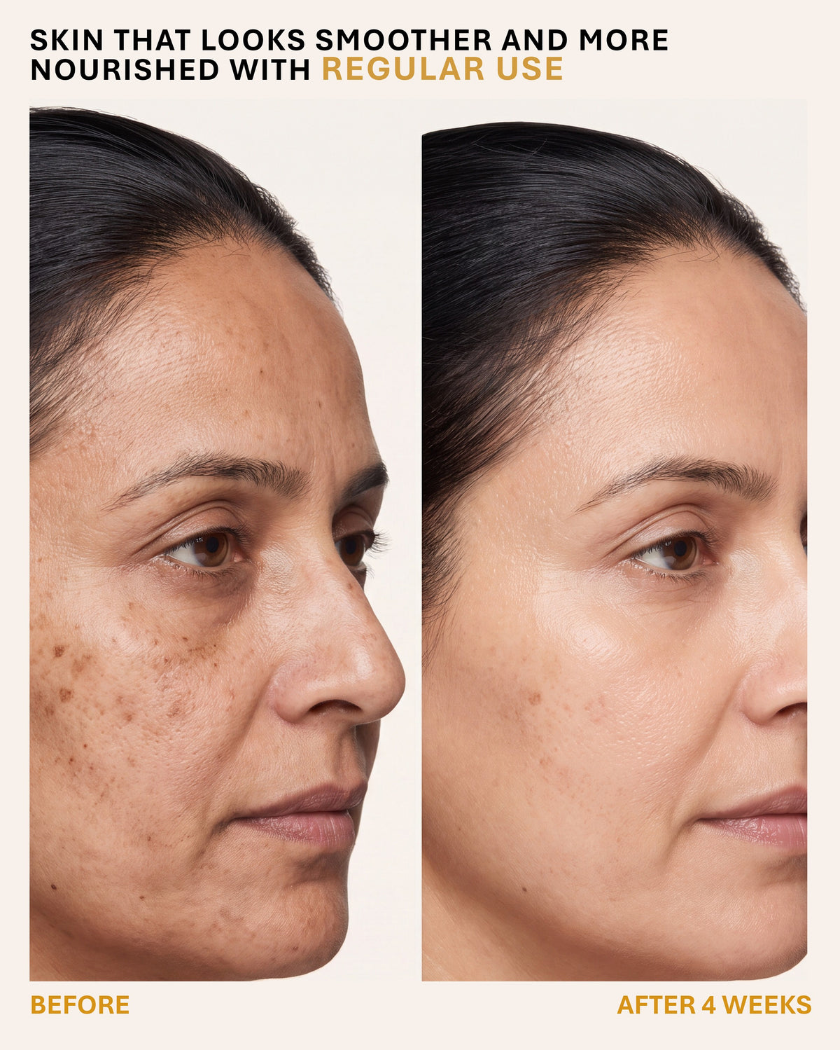 Eldelie Skin Repair Cream (Coenzyme Q10 + Vitamin E)